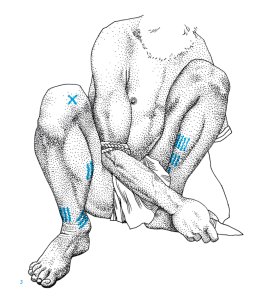 Points communs