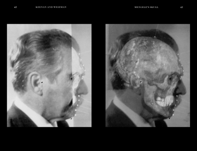 Mengele's Skull